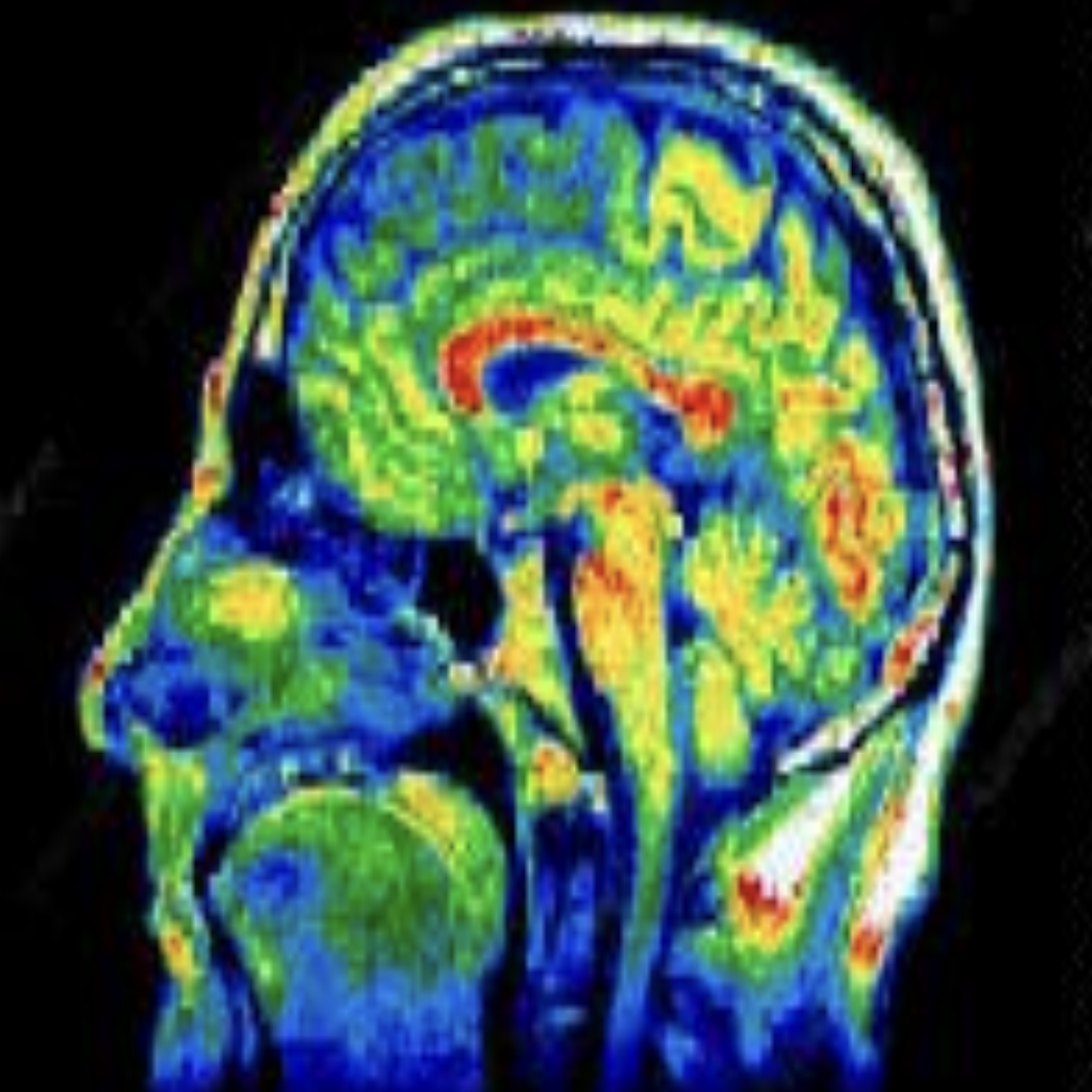Visual preview for Enhancing Radiological Imaging for Better Healthcare Outcomes Through High Performance Hybrid Approach